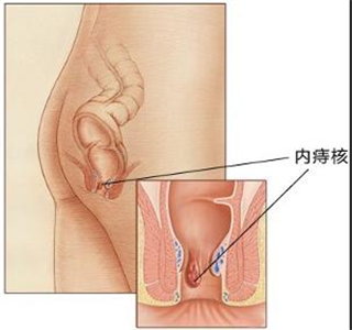 阜阳兆岐肛肠医院